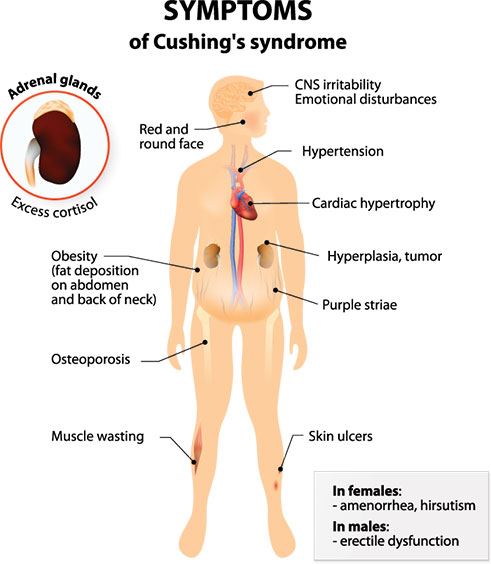 OVERUSE OF CORTICOSTEROIDS LIKE PREDNISONE